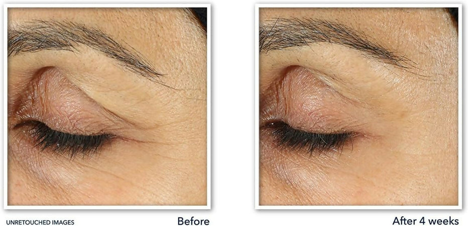 crema ROC line smooting  15ml 5