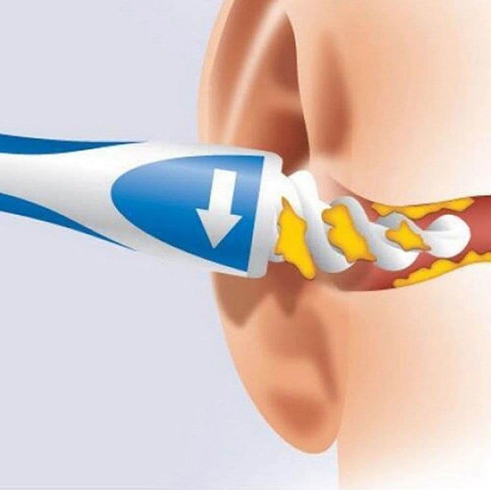 PULISCI PULITORE PER ORECCHIE ELIMINA RIMUOVI LEVA CERUME COTTON FIOC A SPIRALE - 4