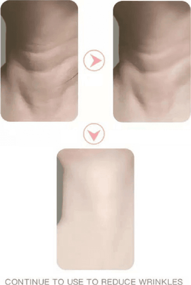 DISPOSITIVO MASSAGGIATORE DI BELLEZZA ANTIETÀ PER COLLO VISO RICARICABILE Q-MJ10 - 10
