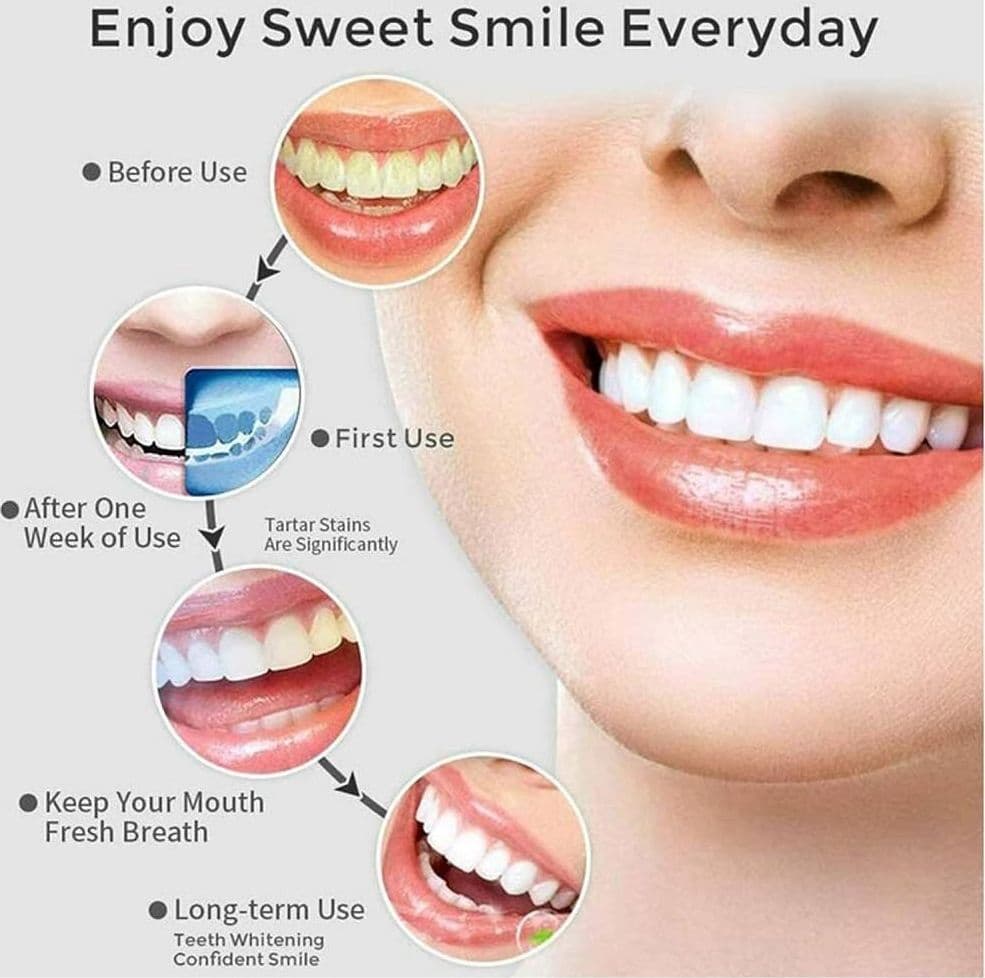 IDROPULSORE DENTALE PORTATILE 3 MODALITÀ 4 UGELLI RICAMBIO IPX7 USB RICARICABILE - 9