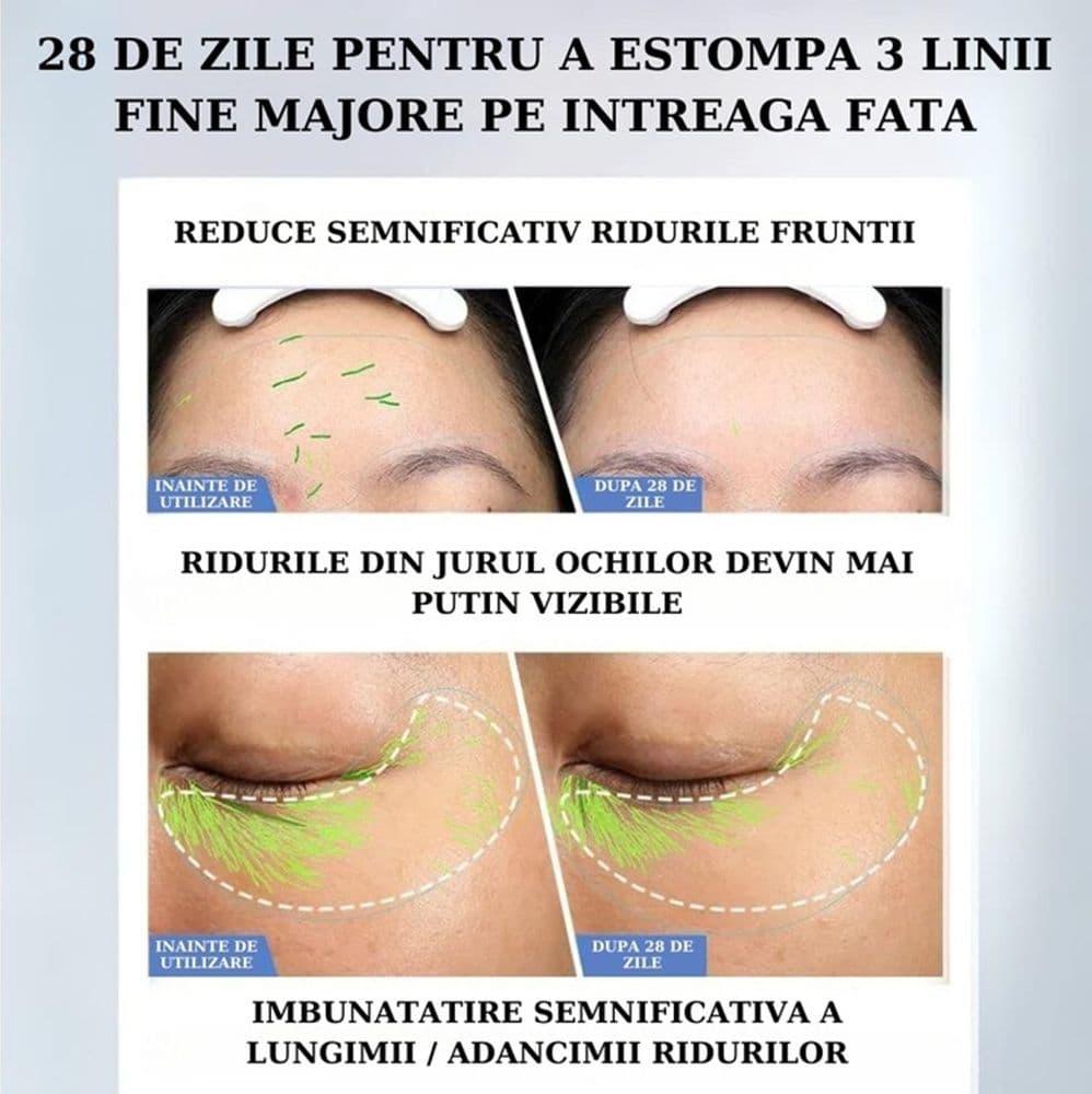 DISPOSITIVO ANTIRUGHE LIFTING FACCIALE RIVITALIZZA RASSODA SCHIARISCE VISO USB PORTATILE - 8