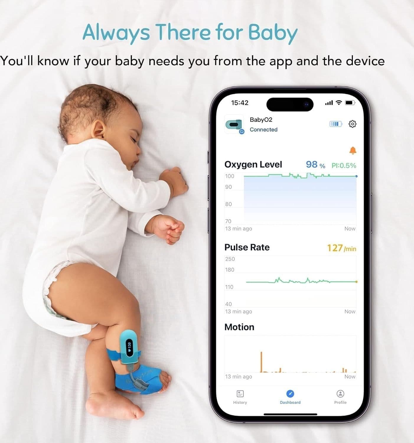Pulsossimetro Pulsimetro pediatrico BabyO2 infantile saturimetro neonati - 5