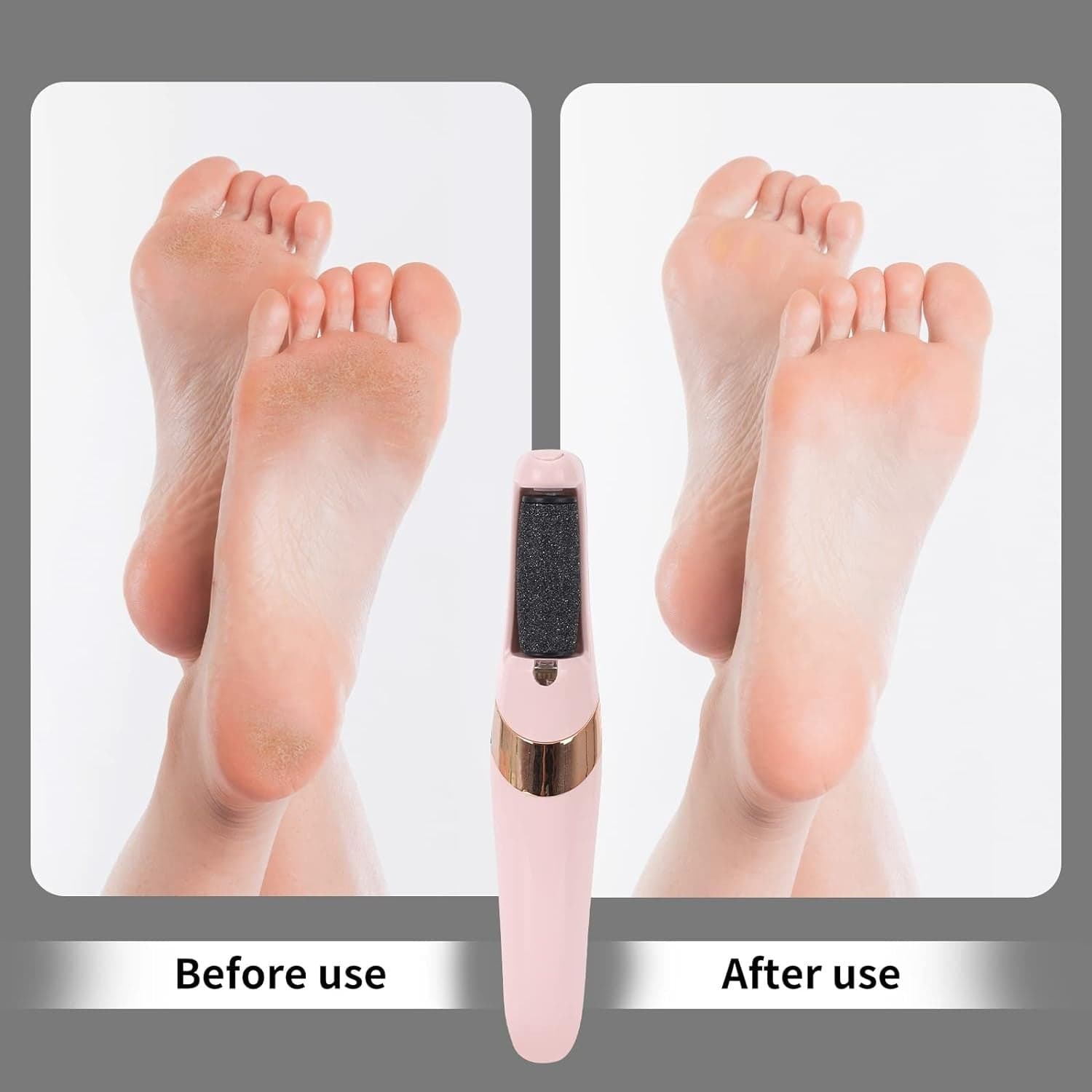 PEDICURE A BATTERIA RICARICABILE ELIMINA CALLI RIMUOVI DURONI PIEDI ESFOLIANTE in Lime per pedicure Trade Shop italia - Napoli, commercioVirtuoso.it