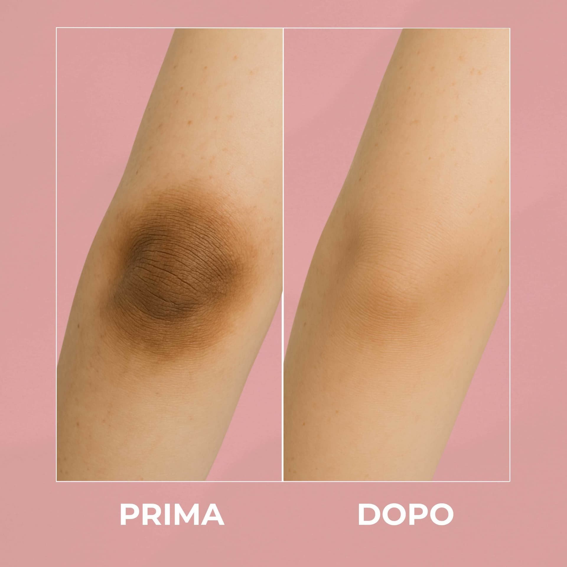 Dr White Crema Sbiancante Parti Intime – Schiarente Intimo per Uomo e Donna – Rimuove Macchie e Uniforma il Tono della Pelle – 100ml – AlohaLabs in Creme per il corpo BasketGuru Italia - Palermo, commercioVirtuoso.it
