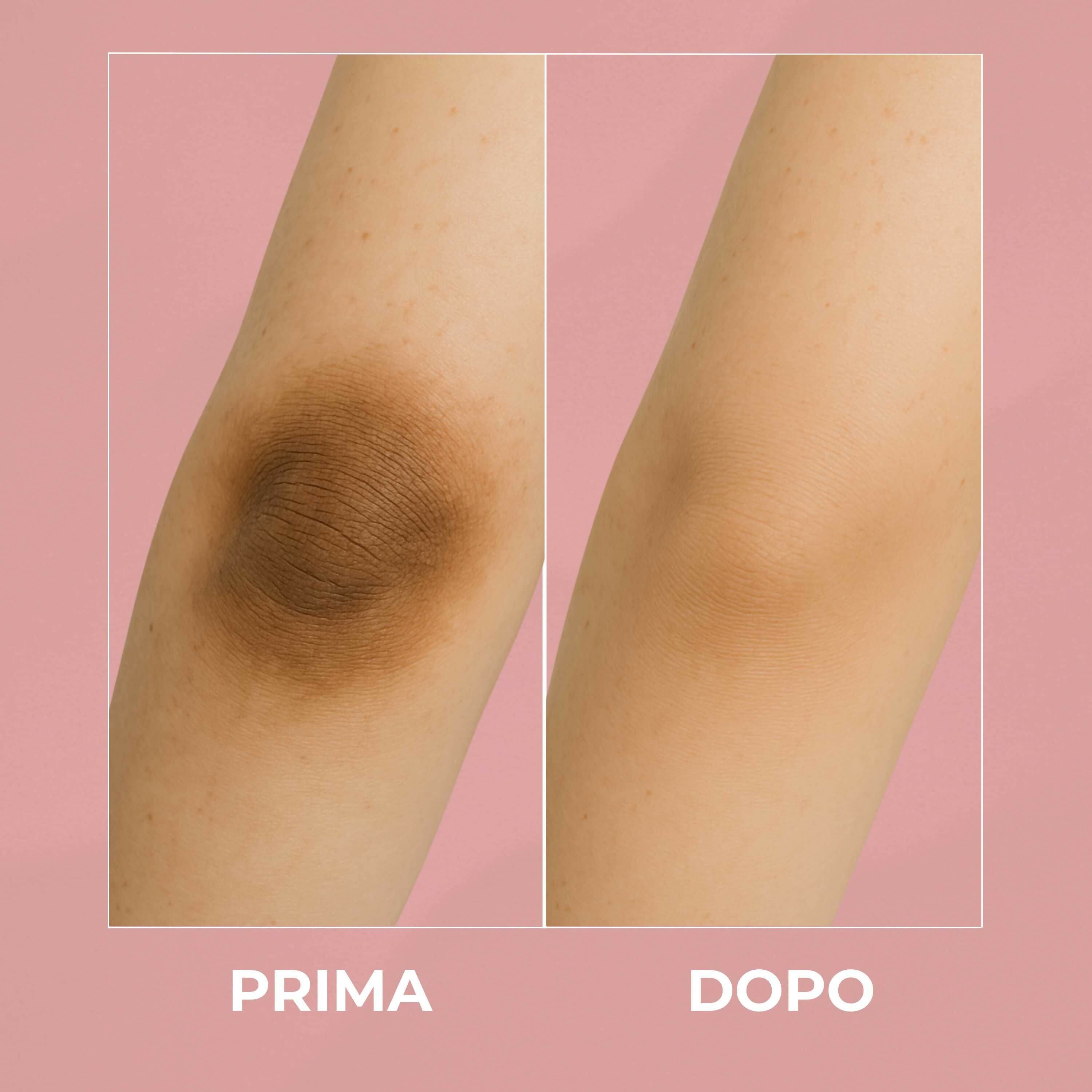 Dr White Crema Sbiancante Parti Intime – Schiarente Intimo per Uomo e Donna – Rimuove Macchie e Uniforma il Tono della Pelle – 100ml – AlohaLabs in Creme per il corpo BasketGuru Italia - Palermo, commercioVirtuoso.it
