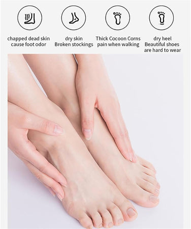 Pedicure A Batteria Ricaricabile Elimina Calli Rimuovi Duroni Piedi Esfoliante