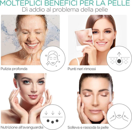 VOYOR Pulizia Viso Ultrasuoni Rimozione Delicata dei Punti Neri Skin Scrubber