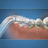Punta per idropulsore - WATERPIK - Ortodontico - Elimina placca - Apparecchi dentali speciali