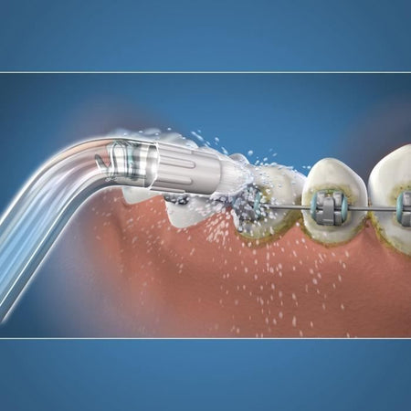 Punta per idropulsore - WATERPIK - Ortodontico - Elimina placca - Apparecchi dentali speciali