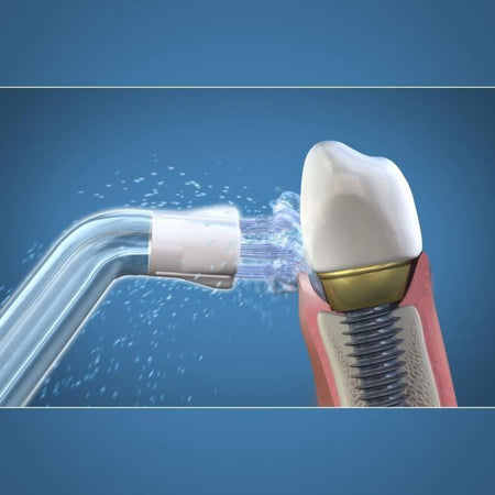 Punta per idropulsore - WATERPIK - Plaque Seeker - Elimina la placca