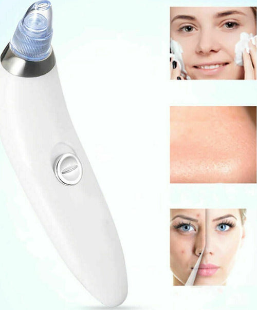 ASPIRA-ELIMINA-RIMUOVI-PUNTI-NERI-PULIZIA-VISO-BRUFOLI-A-BATTERIE-ACNE-BELLEZZA