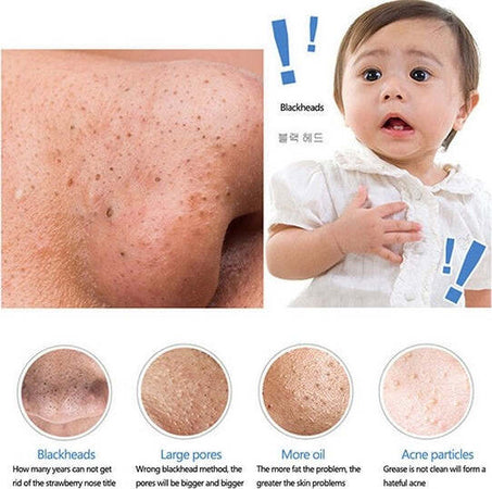 ASPIRATORE FACCIALE PER LA PULIZIA DEL VISO DA PUNTI NERI ACNE E IMPURITÀ HL-308 Bellezza/Accessori e strumenti di bellezza/Strumenti per la cura della pelle/Applicatori e spazzole detergenti/Spazzole e dispositivi per pulizia viso Trade Shop italia - Napoli, Commerciovirtuoso.it