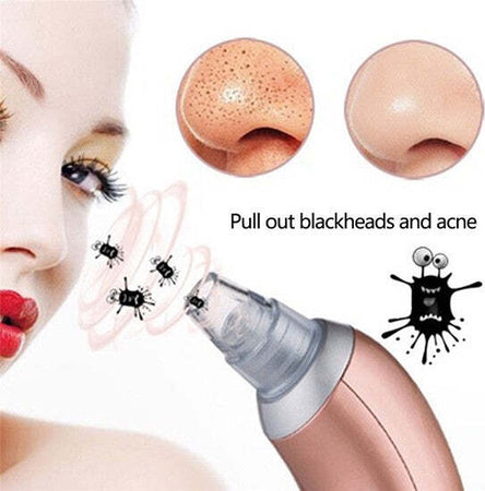 ASPIRATORE FACCIALE PER LA PULIZIA DEL VISO DA PUNTI NERI ACNE E IMPURITÀ HL-308 Bellezza/Accessori e strumenti di bellezza/Strumenti per la cura della pelle/Applicatori e spazzole detergenti/Spazzole e dispositivi per pulizia viso Trade Shop italia - Napoli, Commerciovirtuoso.it