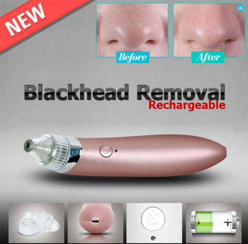Aspiratore-Rimuovere-Punti-Neri-Ad-Ultrasuoni-Pulizia-Viso-Facciale-Portatile
