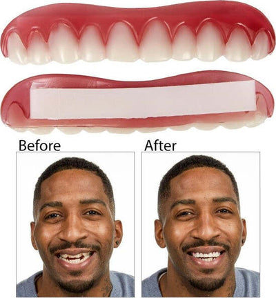 Dentiera-Protesi-Dentale-Denti-Finti-Perfetti-Riutilizzabile-Smontabile-Sorriso
