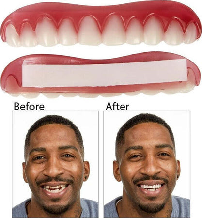 Dentiera-Protesi-Dentale-Denti-Finti-Perfetti-Riutilizzabile-Smontabile-Sorriso