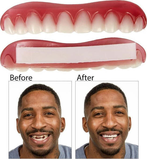 Dentiera-Protesi-Dentale-Denti-Finti-Perfetti-Riutilizzabile-Smontabile-Sorriso