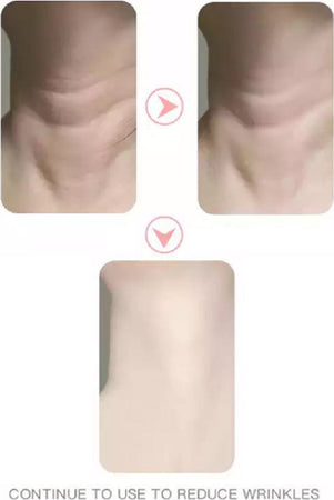 Dispositivo Massaggiatore Di Bellezza Antiet? Per Collo Viso Ricaricabile Q-mj10 Salute e cura della persona/Benessere/Massaggi e relax/Massaggiatori elettrici/Massaggiatori elettrici manuali Trade Shop italia - Napoli, Commerciovirtuoso.it