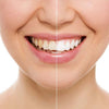DISPOSITIVO PROFESSIONALE SBIANCANTE A LED DENTI DENTAL WHITE RX SORRISO SUPER Salute e cura della persona/Igiene dentale/Sbiancanti denti/Kit per sbiancamento denti Trade Shop italia - Napoli, Commerciovirtuoso.it