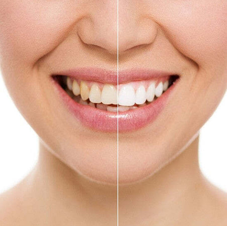 DISPOSITIVO PROFESSIONALE SBIANCANTE A LED DENTI DENTAL WHITE RX SORRISO SUPER Salute e cura della persona/Igiene dentale/Sbiancanti denti/Kit per sbiancamento denti Trade Shop italia - Napoli, Commerciovirtuoso.it