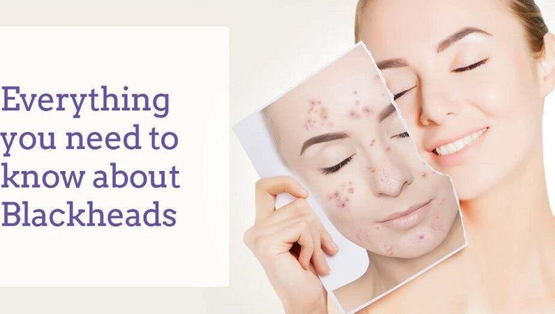 Dispositivo Ricaricabile Per Pulizia Viso Pori Macchie Scure Punti Neri Q-m300 Bellezza/Accessori e strumenti di bellezza/Strumenti per la cura della pelle/Strumenti rimozione punti neri Trade Shop italia - Napoli, Commerciovirtuoso.it