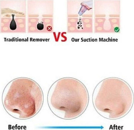 Dispositivo Strumento Di Aspirazione Per La Pulizia Dei Punti Neri Viso Q-m303 Bellezza/Accessori e strumenti di bellezza/Strumenti per la cura della pelle/Strumenti rimozione punti neri Trade Shop italia - Napoli, Commerciovirtuoso.it