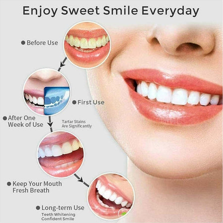 Idropulsore Dentale Portatile 3 Modalit? 4 Ugelli Ricambio Ipx7 Usb Ricaricabile Salute e cura della persona/Igiene dentale/Accessori per idropulsori e fili interdentali elettrici Trade Shop italia - Napoli, Commerciovirtuoso.it