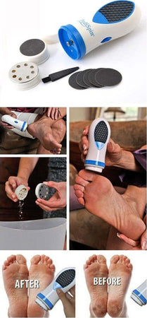 Kit Pedicure Per Pelle Secca E Calli Cura Del Piede Con 2 Accessori Pedi Spin Bellezza/Manicure e pedicure/Strumenti e accessori/Lime per pedicure Trade Shop italia - Napoli, Commerciovirtuoso.it