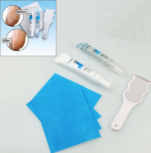 KIT PEDICURE TRATTAMENTO RIMUOVI CALLI ELIMINA DURONI DAI PIEDI IN POCHI MINUTI  Trade Shop italia - Napoli, Commerciovirtuoso.it