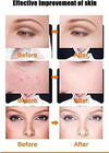 Maschera Viso Fototerapia Spettro Bellezza Acne Pelle Anti Rughe Radiofrequenza Salute e Bellezza > Cura del corpo e viso Trade Shop italia - Napoli, Commerciovirtuoso.it