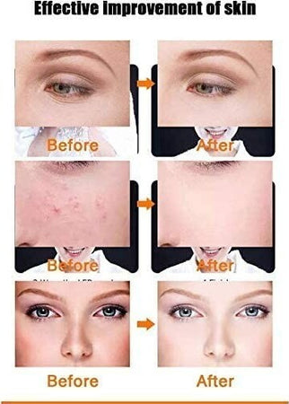 Maschera Viso Fototerapia Spettro Bellezza Acne Pelle Anti Rughe Radiofrequenza Salute e Bellezza > Cura del corpo e viso Trade Shop italia - Napoli, Commerciovirtuoso.it