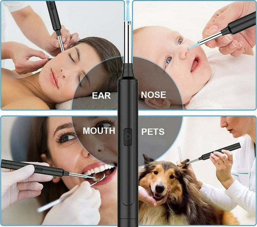 Otoscopio Ispezione Orecchio Kit Rimozione Cerume Wifi Microscopio Camera Q-es1 Salute e Bellezza > Cura del corpo e viso Trade Shop italia - Napoli, Commerciovirtuoso.it