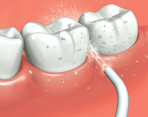Panasonic Beccuccio di ricambio per irrigatore orale EW0955W503 Salute e cura della persona/Igiene dentale/Accessori per idropulsori e fili interdentali elettrici Scontolo.net - Potenza, Commerciovirtuoso.it