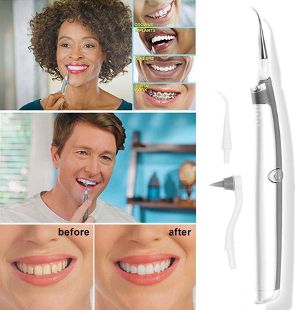 Pulizia Denti Ad Ultrasuoni Con Led A Batterie Rimozione Tartaro Placca Macchie Salute e cura della persona/Igiene dentale/Pulizia interdentale/Idropulsori e fili interdentali elettrici Trade Shop italia - Napoli, Commerciovirtuoso.it