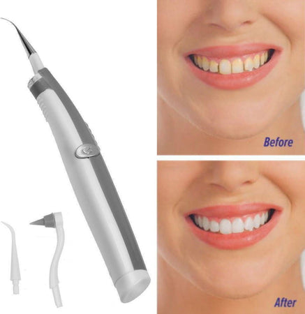 Pulizia Denti Ad Ultrasuoni Con Led A Batterie Rimozione Tartaro Placca Macchie Salute e cura della persona/Igiene dentale/Pulizia interdentale/Idropulsori e fili interdentali elettrici Trade Shop italia - Napoli, Commerciovirtuoso.it