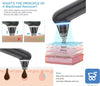 Strumento per la Rimozione Punti Neri con Luce Blu Indicatore LED Xpre202