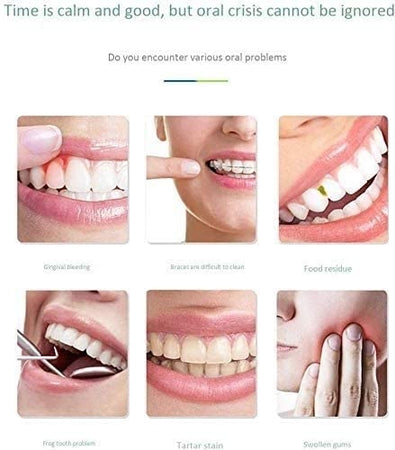 Idropulsore Dentale Irrigatore Orale Elettrico Ad Acqua Cordless  Ricaricabile Per I Denti Cura Orale Portatile Per Viaggi E Casa -  commercioVirtuoso.it